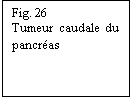 Zone de Texte: Fig. 26
Tumeur caudale du pancras
